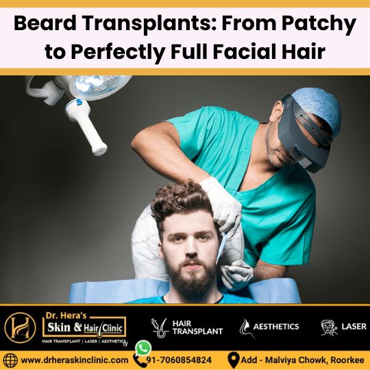 beard transplant from patchy to perfectly full facial hair