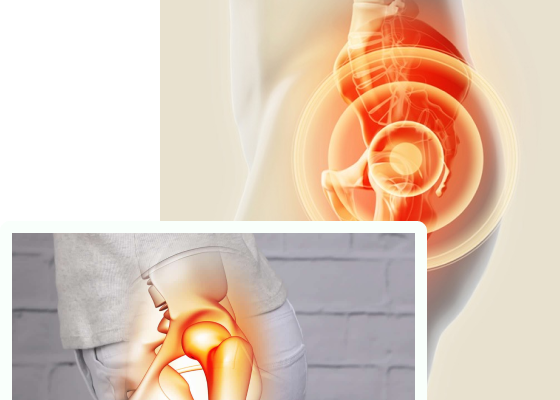 hip replacement in lahore