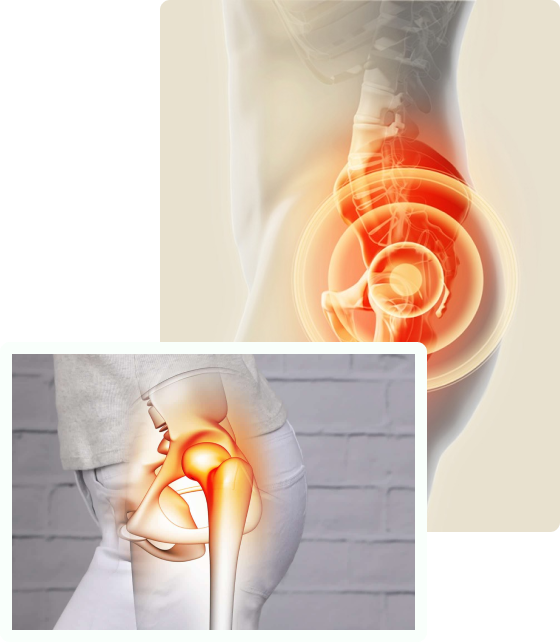 hip replacement in lahore