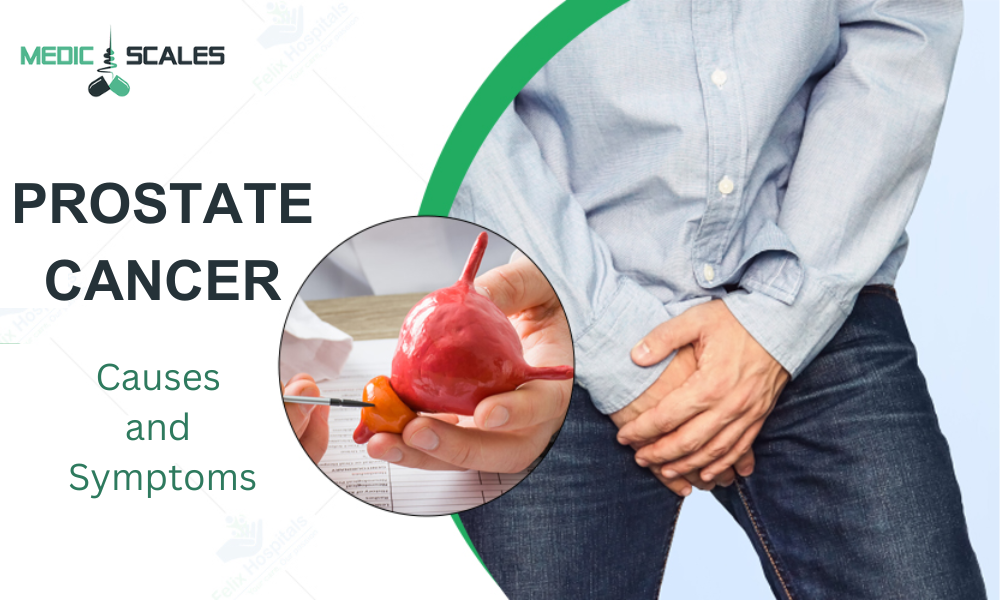 The Causes and Symptoms of Prostate Cancer