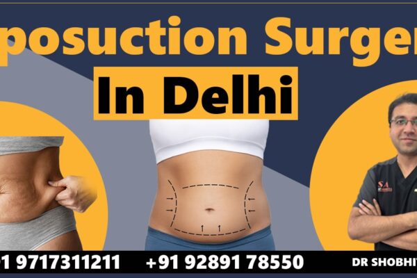 Liposuction Surgery