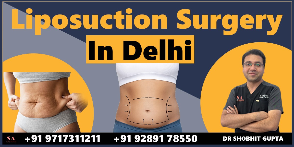 Liposuction Surgery