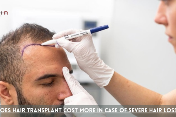 hair transplant cost