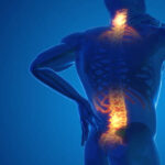 Back Pain Management Guide