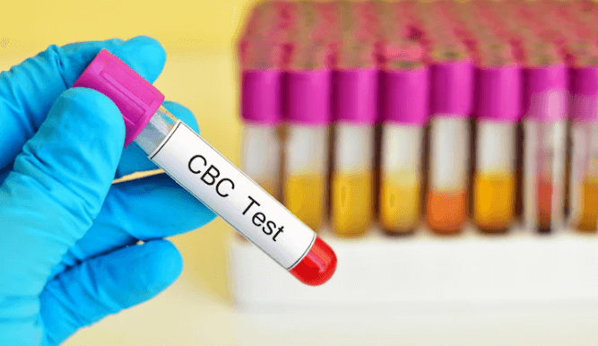 cbc test in Chennai