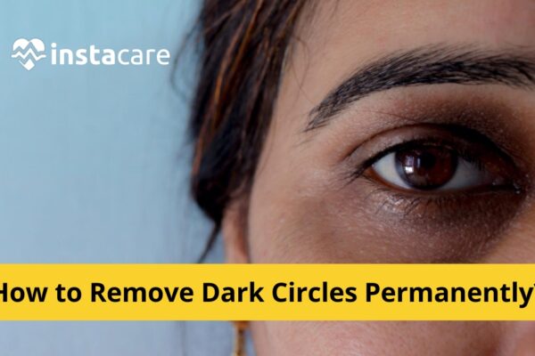 Dark Circles