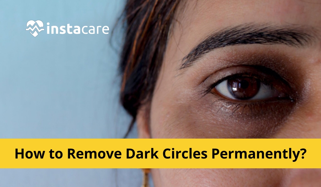 Dark Circles